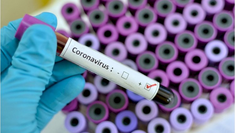 Korona Virüsü Hakkında Bilinmesi Gerekenler