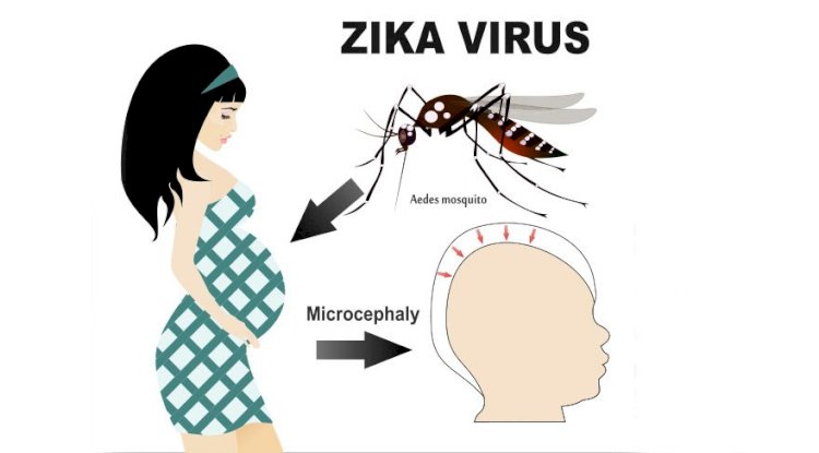 Zika Virüsü Nedir Belirtileri Nelerdir?